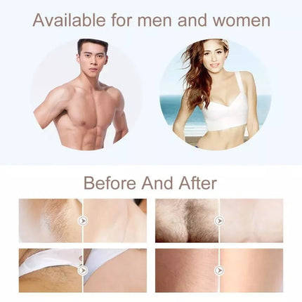 BDI Permanent IPL Hair Removal Device 400K Pulses Intense Pulsed Light Epilator
